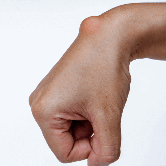 Was ist ein Ganglion?