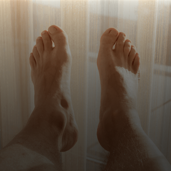 wie kommt es zum spreizfuß